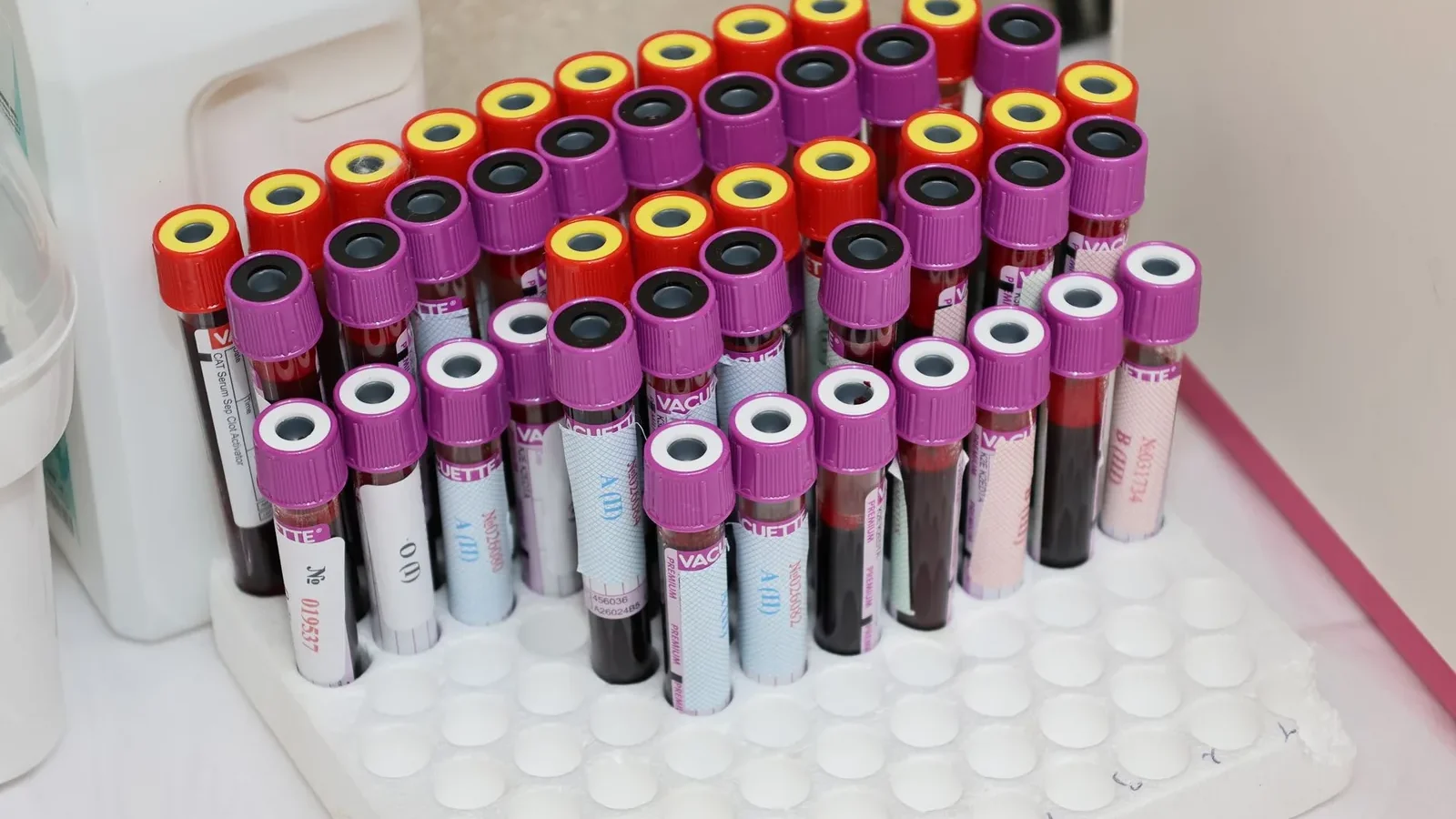 Rows of blood vials in a laboratory setting, ready for analysis.