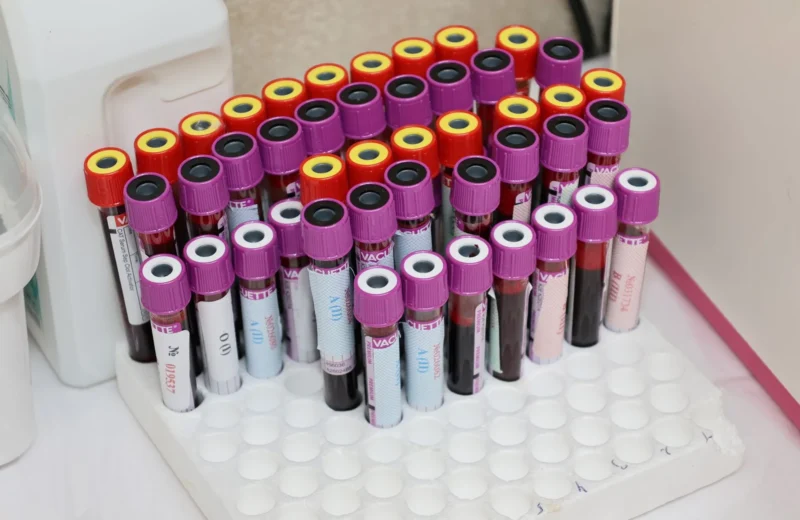 Rows of blood vials in a laboratory setting, ready for analysis.