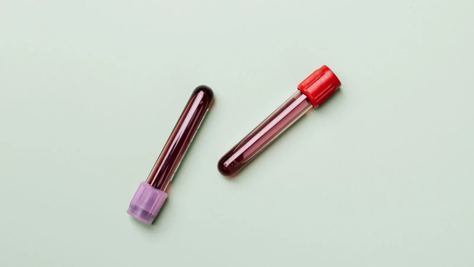 Blood samples in test tubes on a light background, ideal for medical and laboratory themes.